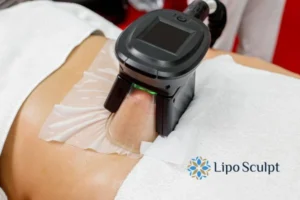 Does Fat Freezing At Home Work? 3 Fat freezing at home from Lipo Sculpt Iver